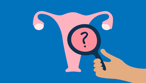 ENDOMETRIOSE.png